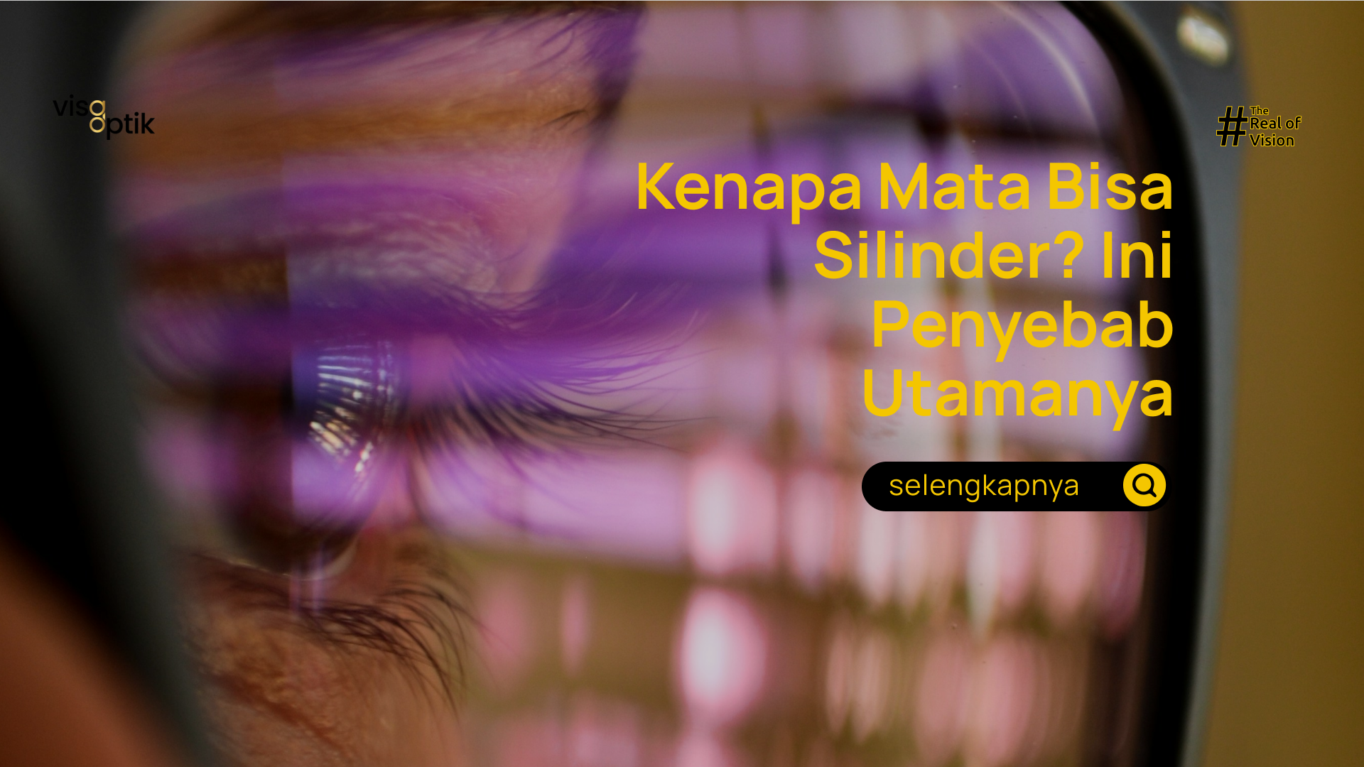 kenapa mata bisa silinder